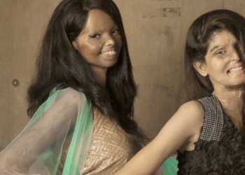 Acid Attack victims pension