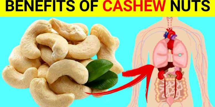 Health Benefits of Cashew Nuts