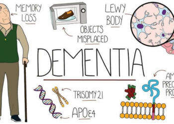 Alzheimer Quotes and Captions