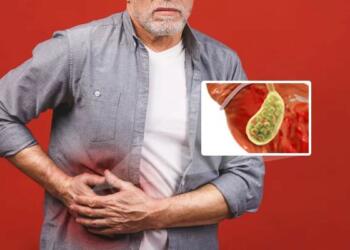 Management of Gallstones and How to Deal With It