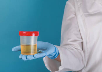 How is Urine Infection Tested?