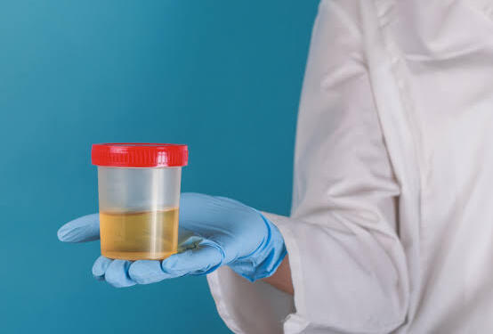 How is Urine Infection Tested?