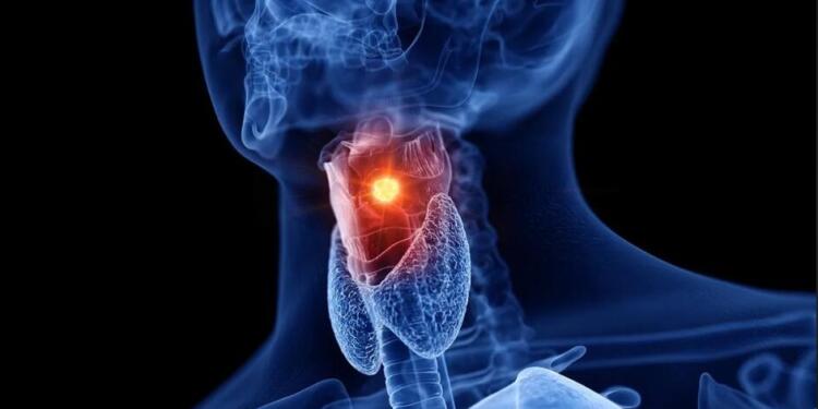 A Deep Look into Mucormycosis and Throat Cancer