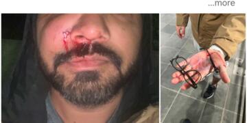 Indian-Origin Man Alleges “Unprovoked” Racist Attack in Dublin, Says Violence Against Minorities Rising in Ireland