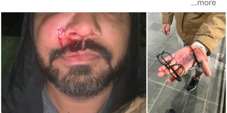 Indian-Origin Man Alleges “Unprovoked” Racist Attack in Dublin, Says Violence Against Minorities Rising in Ireland