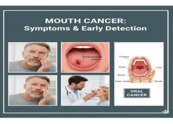The Silent Symptoms of Mouth Cancer: What You Might Be Missing
