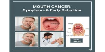 The Silent Symptoms of Mouth Cancer: What You Might Be Missing