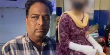Shocking Twists In Delhi “Acid Attack” Case: Victim’s Father Aqeel Khan Confesses to Plotting Fake Assault. How a Revenge Plot Backfired?