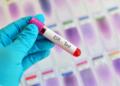 Erythrocyte Sedimentation Rate (ESR) Test: Meaning, Normal Range & Uses