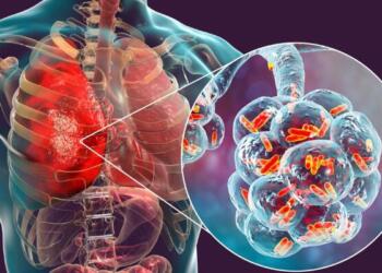 Centre Unveils AI-Led Precision Strategy to Eliminate TB, Zeroes In on Delhi’s 38 High-Burden Wards