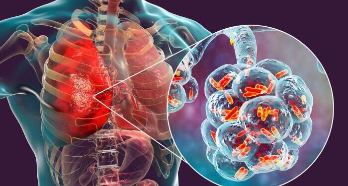 Centre Unveils AI-Led Precision Strategy to Eliminate TB, Zeroes In on Delhi’s 38 High-Burden Wards